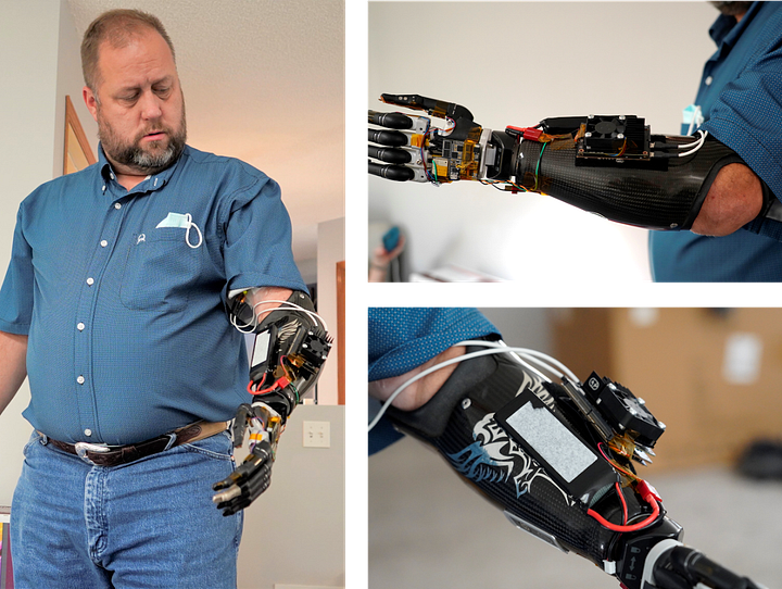 Visual example from An Amputee with an AI Powered Hand!