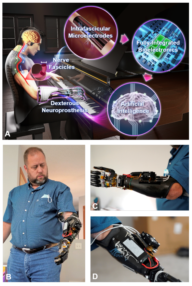 Visual example from An Amputee with an AI Powered Hand!