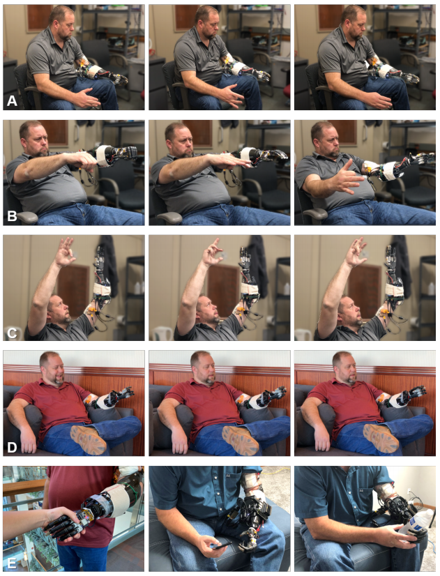 Visual example from An Amputee with an AI Powered Hand!